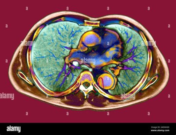 Major artery from the heart